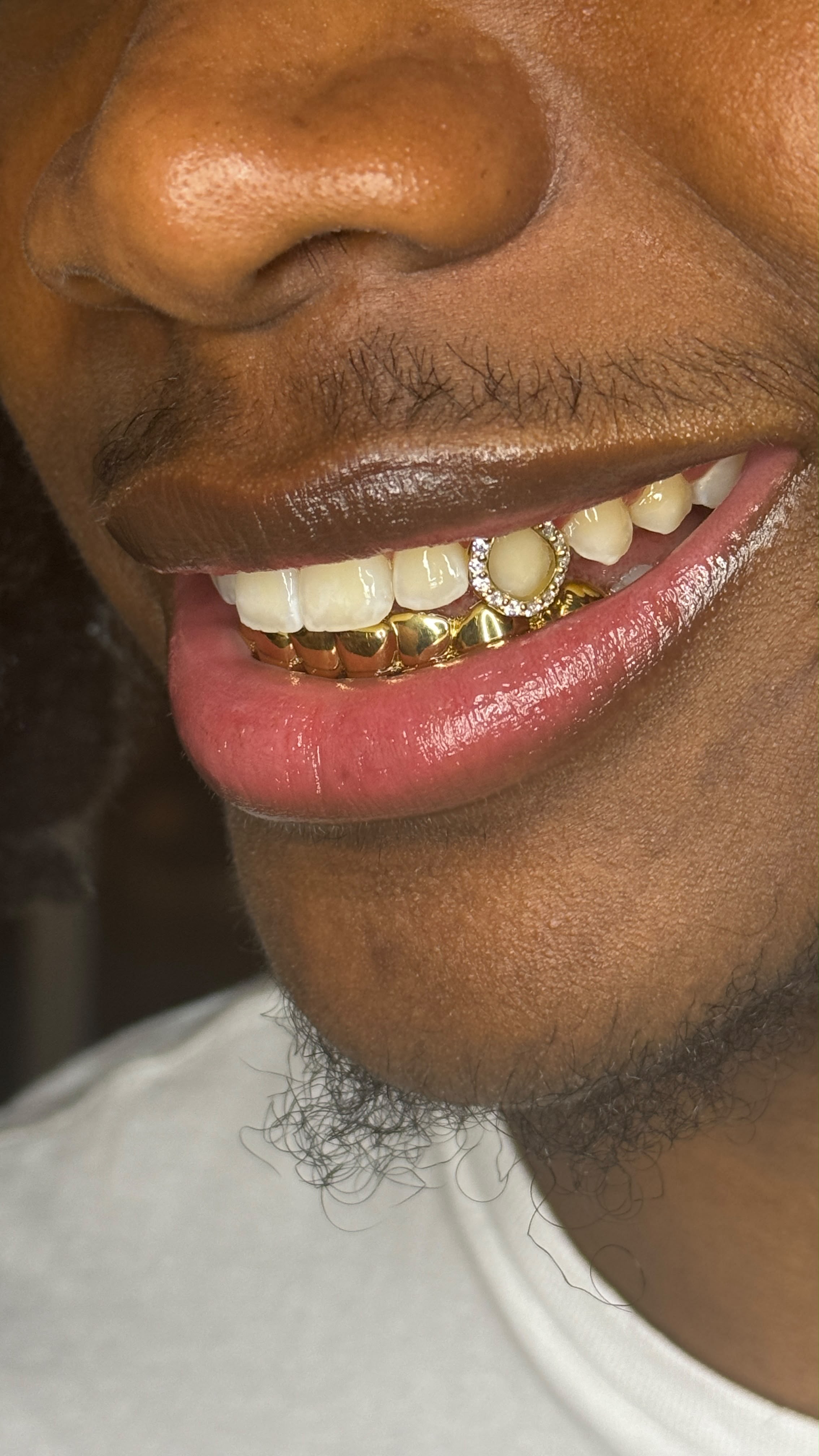Grillz du bas plein or et dent sertie en haut, porté