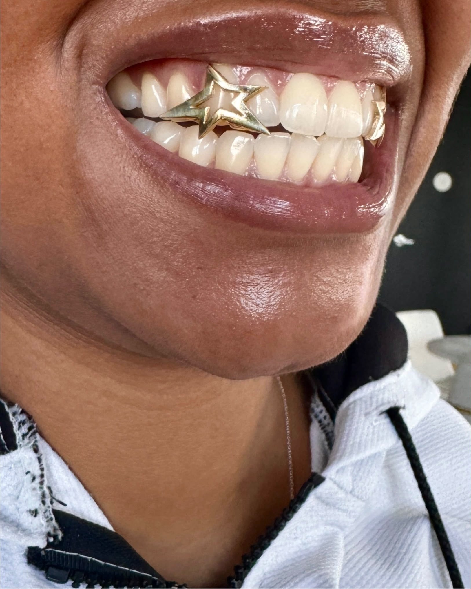 Grillz étoile sur canine, porté