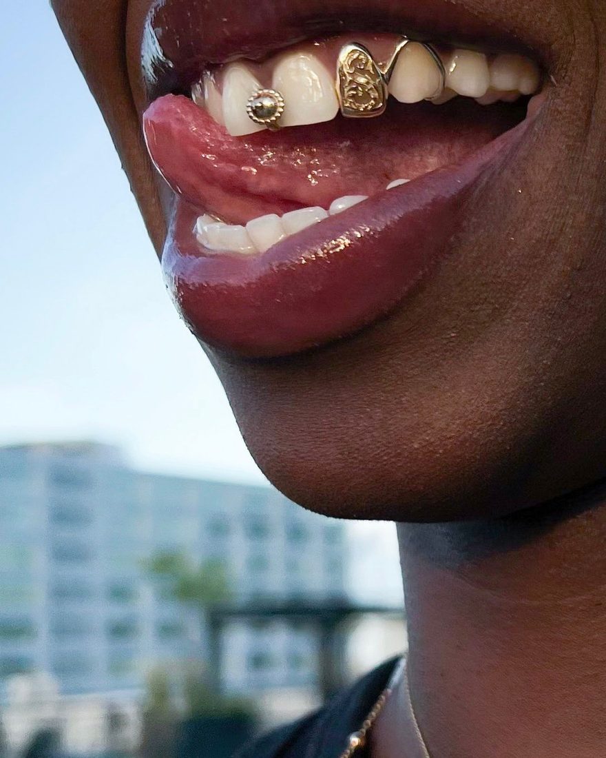 Grillz sur-mesure porté, profil
