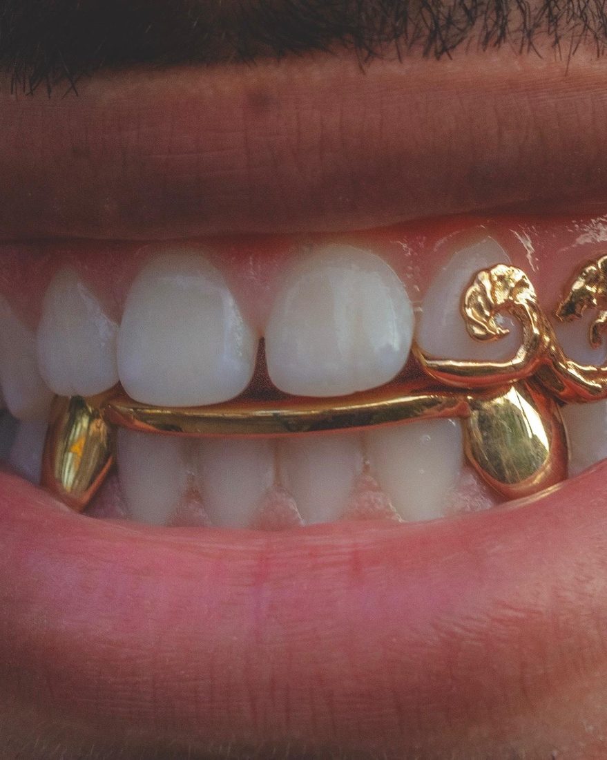 Grillz canine reliée porté