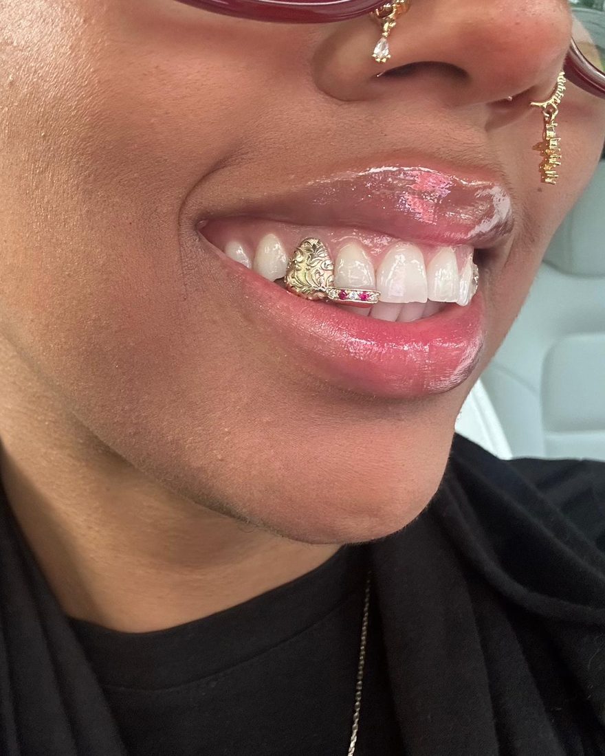 Grillz motif baroque et rubis porté