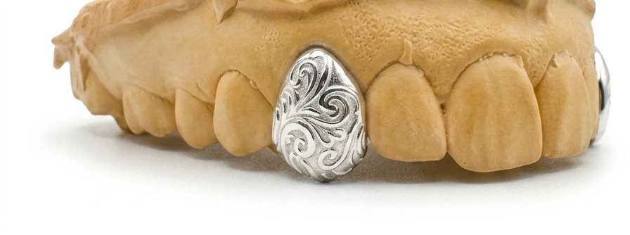 Motif baroque — dent unique